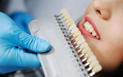 Il colore dei denti